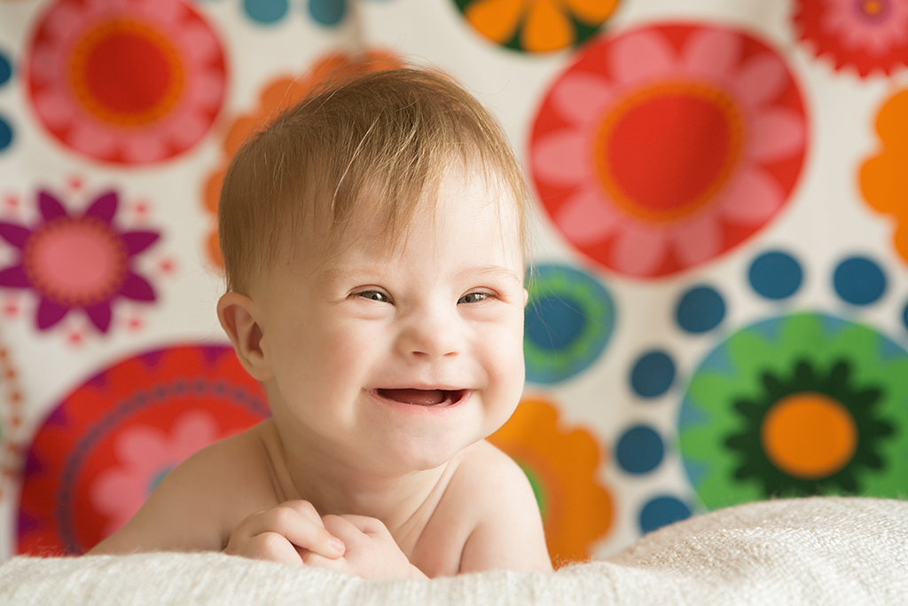 Datos estadísticos del síndrome de Down: número de nacimientos